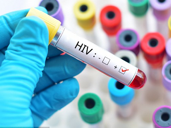 Định nghĩa và khung hình phạt cho tội cố ý truyền HIV cho người khác ?